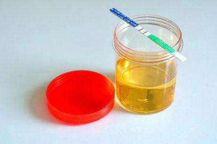 soorten urine voor infectie