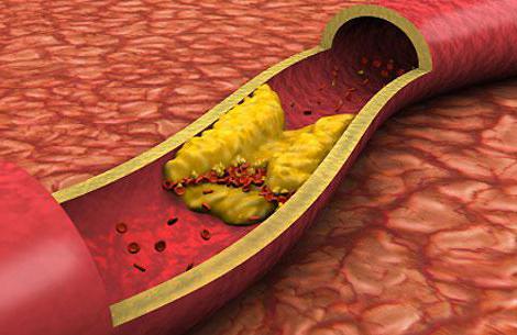 hoe een bloedtest op juiste wijze voor cholesterol kan worden doorgegeven