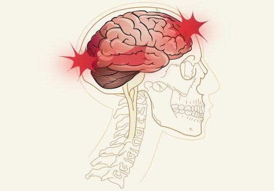 eerste hulp bij craniocerebraal trauma 