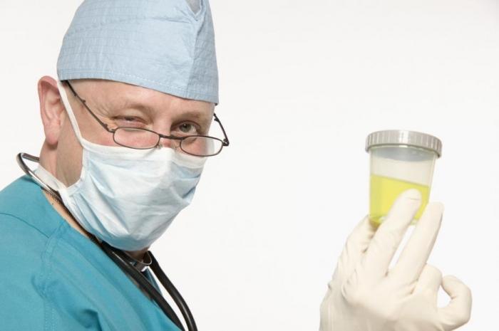 Hoe een urinalyse op de juiste manier door te geven aan het laboratorium