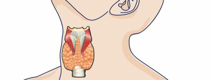 auto-immune thyroiditis met nodale formatiebehandeling met folkremedies 