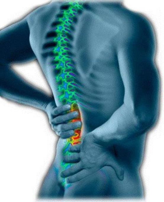 Osteochondrose van de lumbosacrale wervelkolom: oorzaken, symptomen, behandeling
