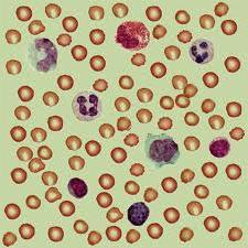 Waarom zijn witte bloedcellen laag?